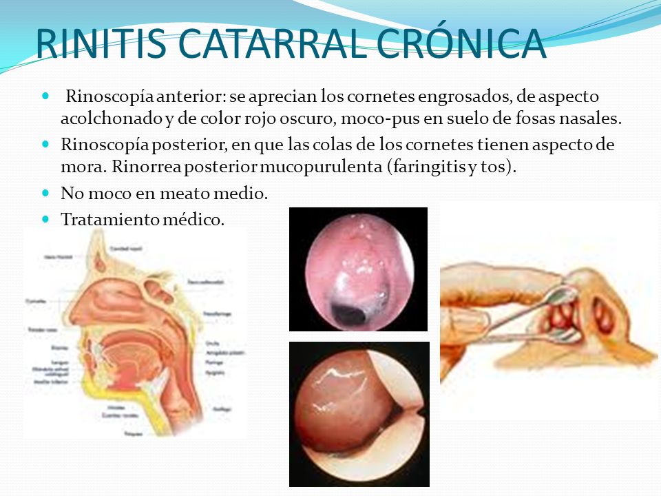 RINOSCOPIA ANTERIOR Y POSTERIOR PDF DOWNLOAD RINOSCOPIA ANTERIOR Y POSTERIOR PDF DOWNLOAD